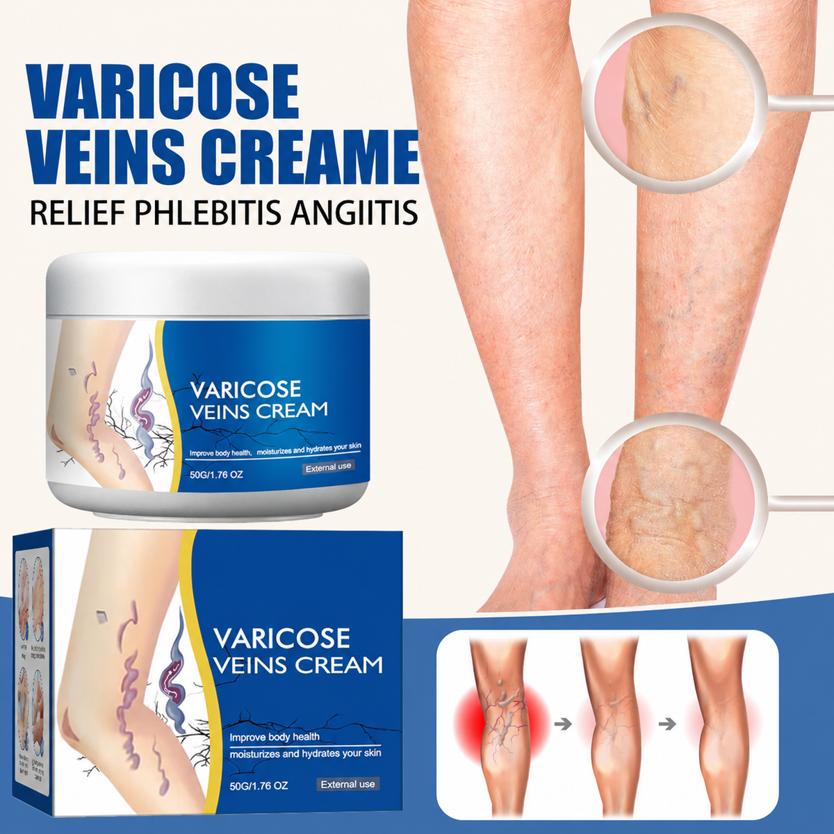 Vein Cream