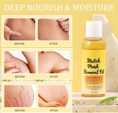 Stretch Mark Oil