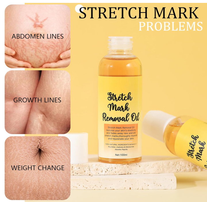 Stretch Mark Oil