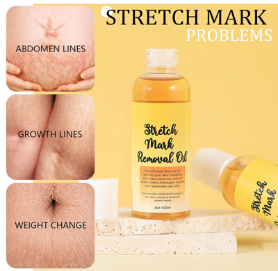 Stretch Mark Oil