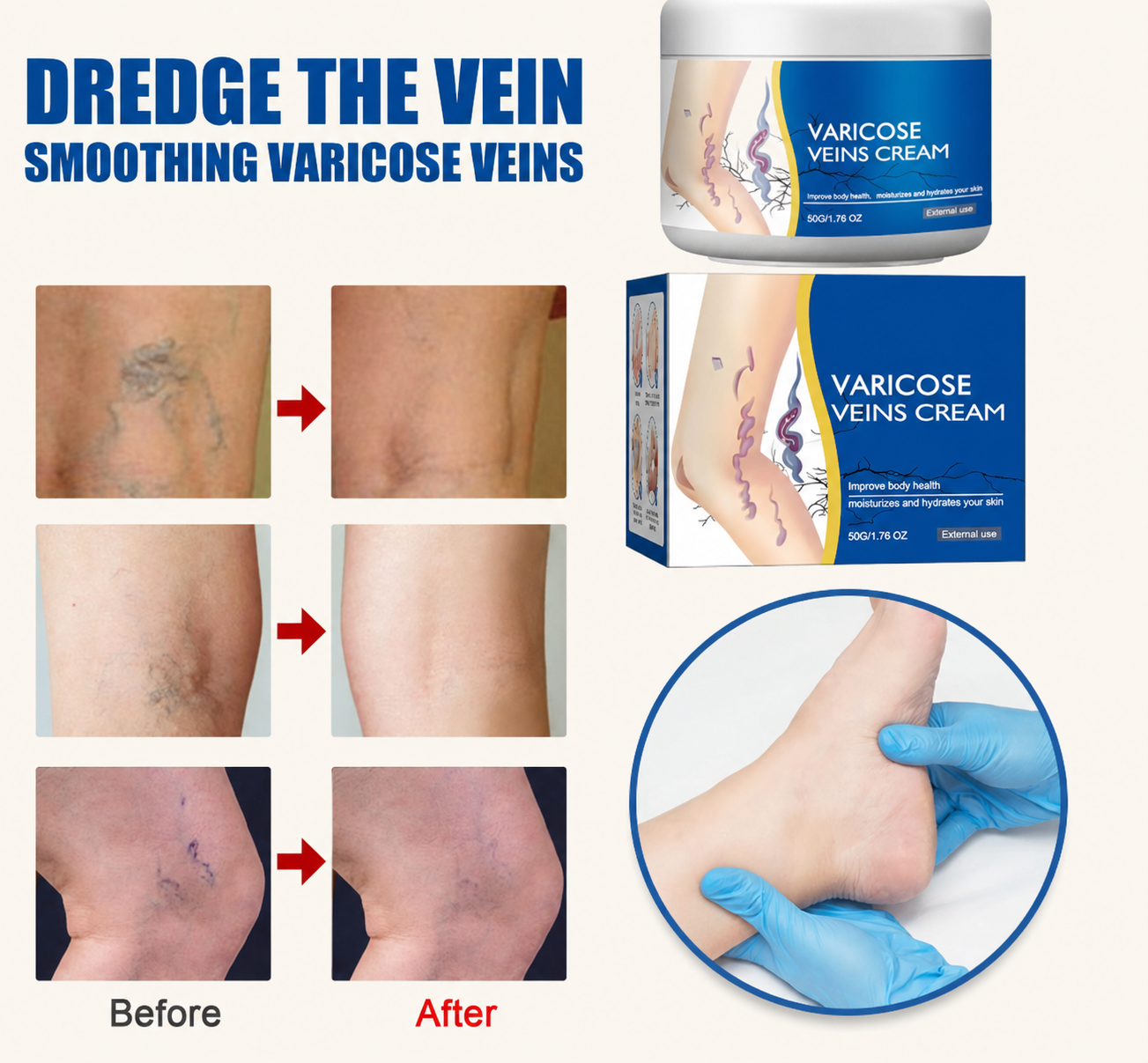 Vein Cream
